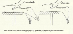 Giannis Mpiris | Yperichos