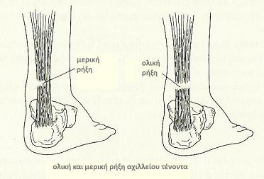 Giannis Mpiris | Yperichos